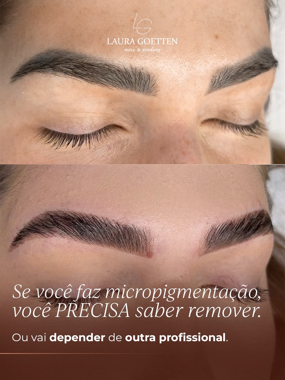 Correção de Sobrancelha